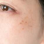 シミ予備軍、見えてますか？