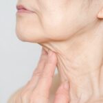 首のシワで見た目年齢+10歳