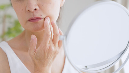 ほうれい線、実は頬のたるみが原因