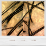 フケ、臭いも気にならなくなった！