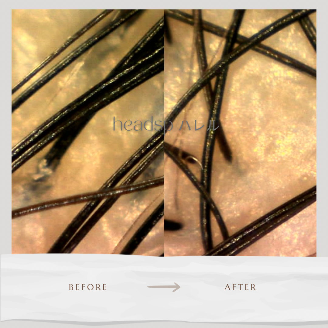 フケ、臭いも気にならなくなった！